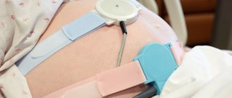 Устройство для кардиотокографии, зафиксированное на животе у беременной женщины