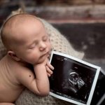 Ultrasound for newborns