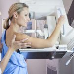 On what day of the cycle is mammography done?