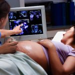Second ultrasound