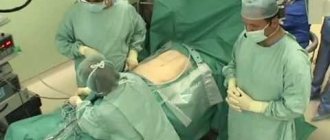 bloating after laparoscopy