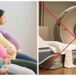 Pregnant women should not have a CT scan