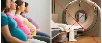 Женщинам в положении нельзя делать компьютерную томографию