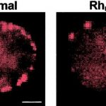 Golden blood with zero Rh is the rarest blood in the world (7 photos)